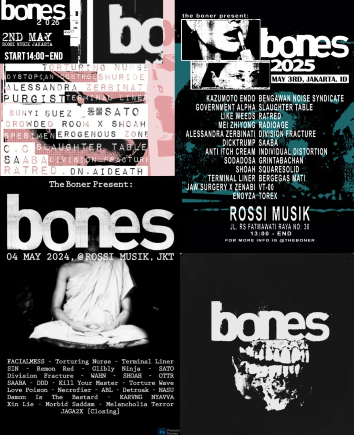 Bones 2025